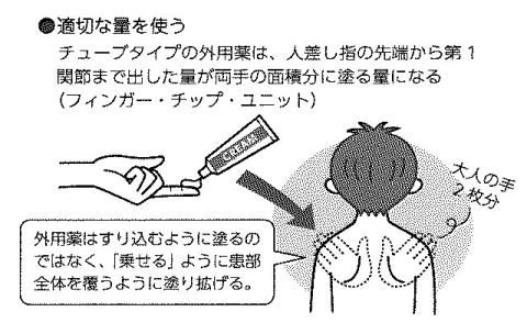 アトピー性皮膚炎イラスト